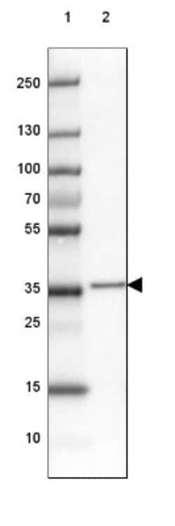 FAM177A1 Antibody, Novus Biologicals 25 &mu;L, Unlabeled:Antibodies, Polyclonal